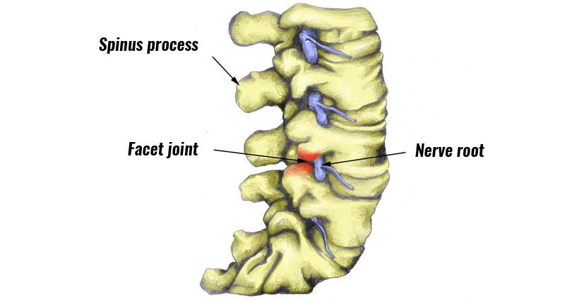 Facet joint image