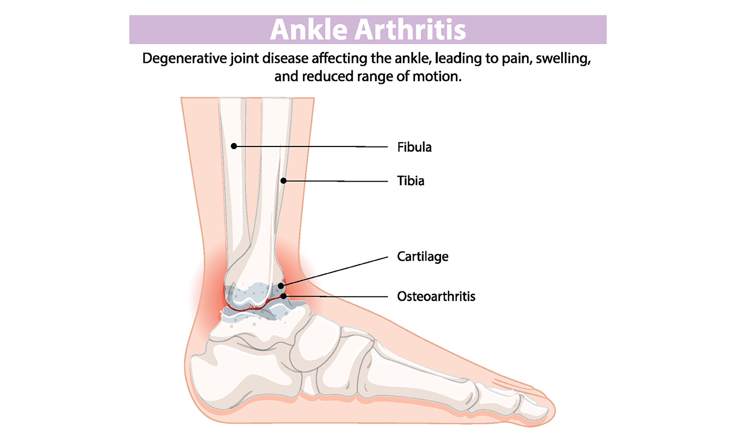 Foot or ankle stiffness as I get older