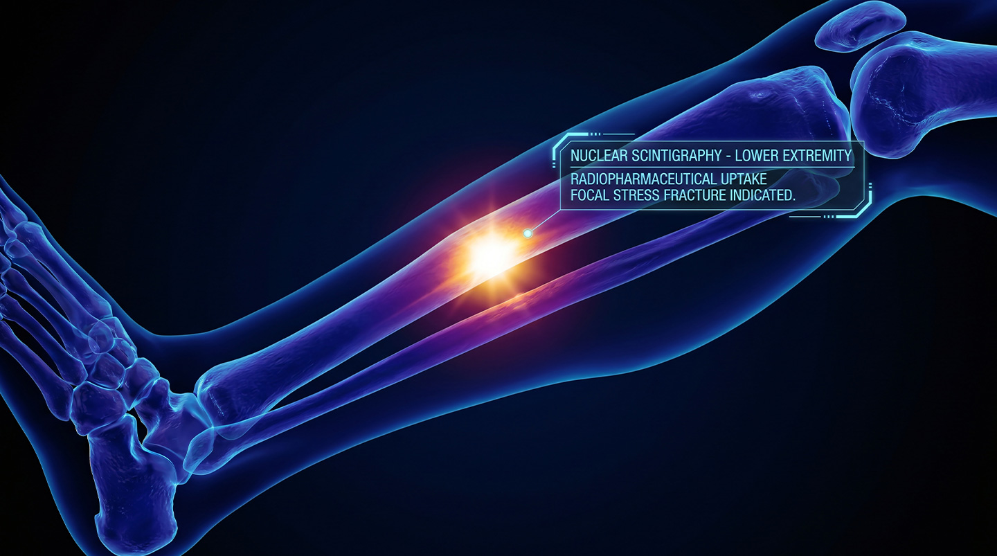 Shin or foot pain that won't ease with rest — is it more than shin splints?